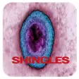 Icon of program: Shingles Disease