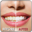 Icono de programa: Teeth Whitening Tips