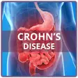 Icon of program: Crohns Disease