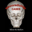 Icon of program: Free Neuroradiology Cases
