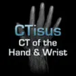 Icon of program: CTisus: CT of the Hand an…