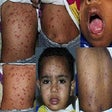 Icono de programa: Dermatology Atlas & Treat…