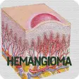 Icon of program: Hemangioma Disease