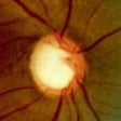Icon of program: Glaucoma Calc