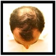 Icon of program: Hair Loss Quiz