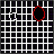 Icon of program: AMD, A Metamorphopsia Det…