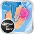 Icon of program: Prostate Cancer @Point of…