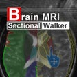 Icon of program: Brain MRI Sectional Walke…