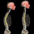 Icono de programa: Kyphosis & Rounded Back b…