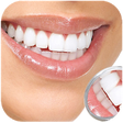 Icono de programa: Whiten Teeth Instantly
