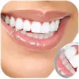 Icon of program: Whiten Teeth Instantly