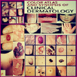 Icon of program: Color Atlas of Skin Disea…