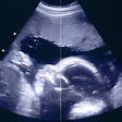 Icon of program: Pregnancy Baby