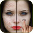 Icono de programa: Pimples removing photo ed…