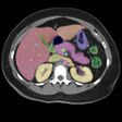 Icon of program: Anatomy on Radiology CT
