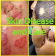 Icon of program: Skin Disease and Care