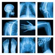 Icon of program: X-Ray -Medical XRay Inter…
