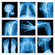 Icon of program: X-Ray -Medical XRay Inter…