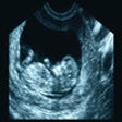 Icon of program: ARDMS Ultrasound Flashcar…