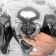 Icon of program: Prostate Cancer Imaging