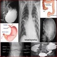 X Ray Chest Urinary Bone & GIT icon