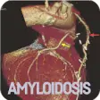Icon of program: Amyloidosis Disease