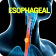 Icon of program: Esophageal Cancer