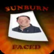 Icon of program: SunburnFaced - The Fake S…