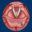 Icon of program: Vocal Folds ID