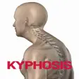 Icon of program: Kyphosis Disease