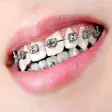 Icon of program: Dental Braces