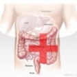 Icon of program: IBD