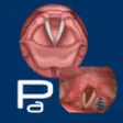 Icon of program: Vocal Pathology: Paresis/…