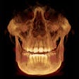 Icon of program: CBCT