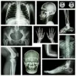 Icon of program: musculoskeletal x-ray int…