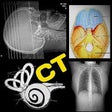 Icono de programa: Atlas of CT Anatomy