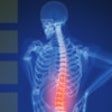 Icon of program: Back Pain Nerve Chart