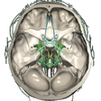 Icon of program: CT Scan Cross Sectional A…