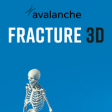 Icon of program: Fracture 3D