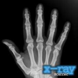 Icon of program: Xray Camera Scanner for W…