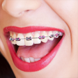 Icon of program: Braces Camera