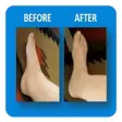Icon of program: Swollen Feet (Guide)