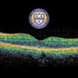 Icon of program: OCT Browser for iPhone