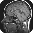 Icono de programa: MRI Viewer
