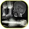 Icon of program: Musculoskeletal X- Rays