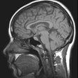 Icon of program: MRI Viewer