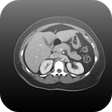 Icono de programa: Radiology CT Viewer