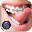 Braces Photo Editor Beauty icon
