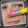 Icon of program: Pimple Eraser