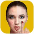 Icon of program: Pimple Eraser And Acne Re…